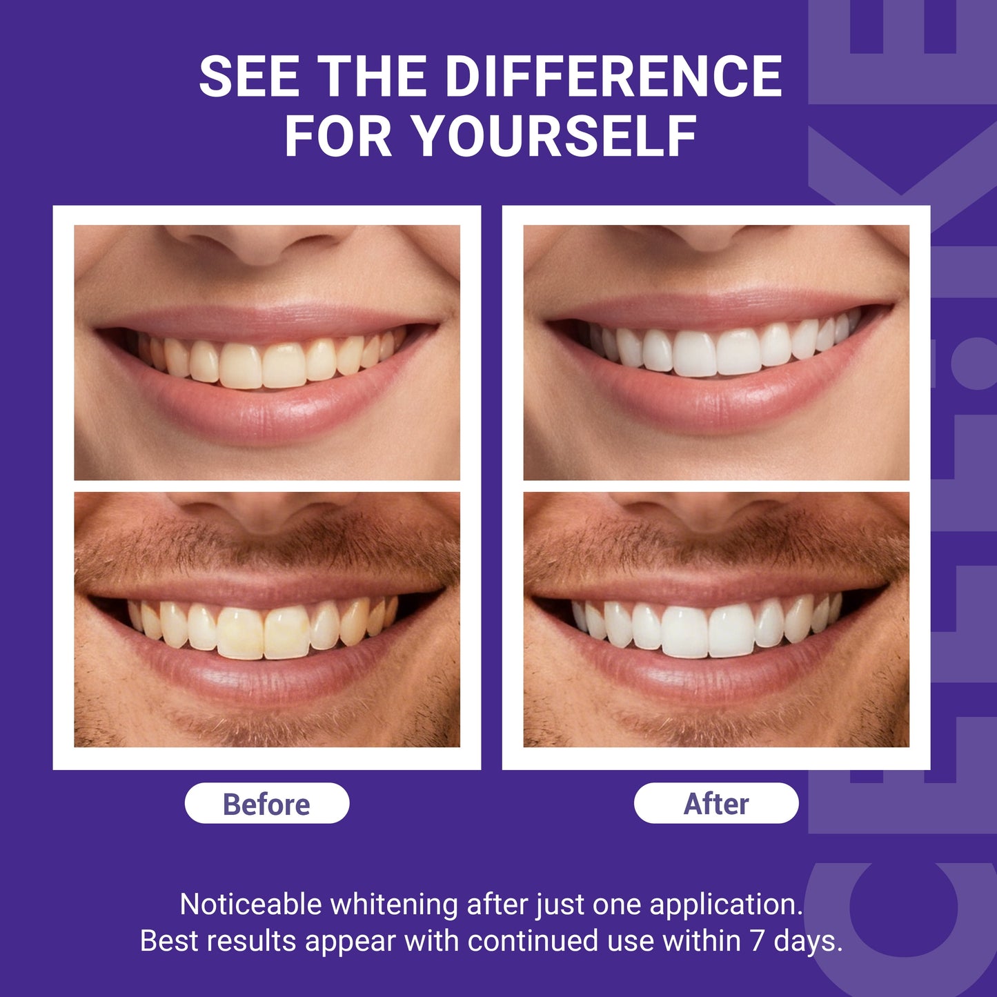 Teeth Whitening Strips (7 Treatments/14 Strips) - Peroxide-Free Whitening Kit with Hydroxyapatite, Enamel Safe + Cheek Retractor, Easy 3-Step At-Home Teeth Whitening for Deep Stain Removal