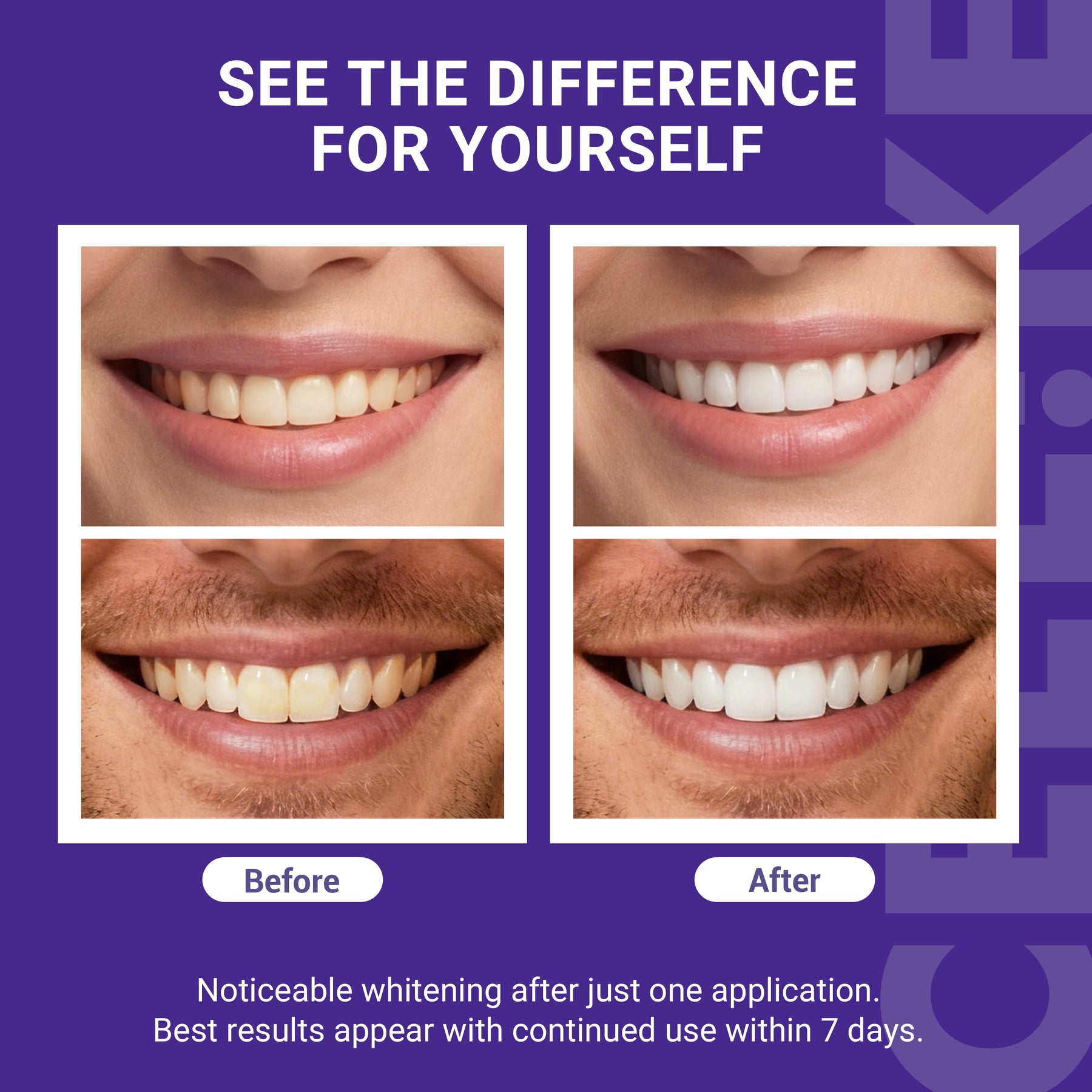 Teeth Whitening Strips (7 Treatments/14 Strips) - Peroxide-Free Whitening Kit with Hydroxyapatite, Enamel Safe + Cheek Retractor, Easy 3-Step At-Home Teeth Whitening for Deep Stain Removal