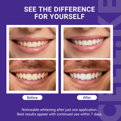 Teeth Whitening Strips (7 Treatments/14 Strips) - Peroxide-Free Whitening Kit with Hydroxyapatite, Enamel Safe + Cheek Retractor, Easy 3-Step At-Home Teeth Whitening for Deep Stain Removal