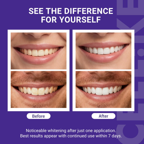 Teeth Whitening Strips (7 Treatments/14 Strips) - Peroxide-Free Whitening Kit with Hydroxyapatite, Enamel Safe + Cheek Retractor, Easy 3-Step At-Home Teeth Whitening for Deep Stain Removal
